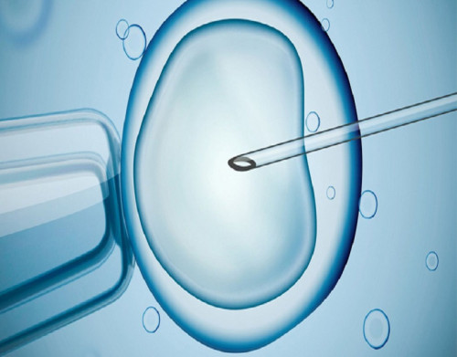At Wings Shri Krishna IVF and Infertility Center, we provide complete treatment for male and female infertility in Bikaner Rajasthan. We provide IVF, mini IVF, IUI, ICSI, andrology etc treatment. It is good to try out IUI commonly known as Intrauterine insemination before deciding to the IVF treatment. The process is quite economical and less invasive. For any consultation or to talk our experts, Call us: 0151 3560631.

For more info:-https://wingsshrikrishnaivf.com/

https://mydrom.com/biz/wings-shri-krishna-ivf-and-infertility-center/