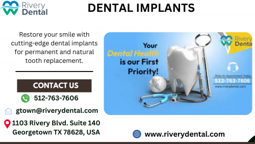 Enhance your smile and restore your confidence with Rivery Dental's advanced dental implants solution. Our experienced team utilizes state-of-the-art technology to provide personalized implant treatments that look and feel natural. Trust us for a brighter, healthier smile that lasts a lifetime.

Visit: https://riverydental.com/dental-implants/